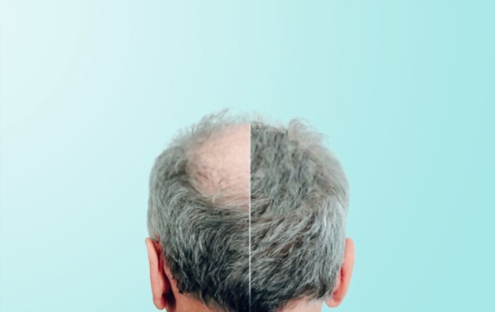 Book An Appointment With Hair Loss Doctor In Michigan Book An Appointment With Hair Loss Doctor In Michigan